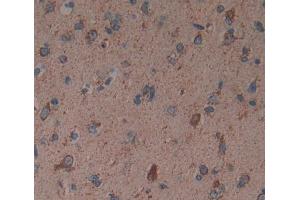 Used in DAB staining on fromalin fixed paraffin- embedded brain tissue (Reticulon 1 antibody  (AA 589-776))