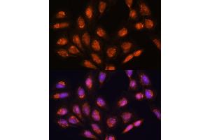 Immunofluorescence analysis of U-2 OS cells using TIMM44 antibody (ABIN7270927) at dilution of 1:100. (TIMM44 antibody  (AA 153-452))