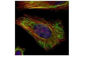 Immunofluorescence (IF) image for anti-Vimentin (VIM) antibody (ABIN2854814)