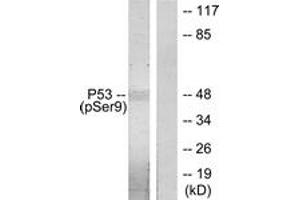 Western Blotting (WB) image for anti-Tumor Protein P53 (TP53) (pSer9) antibody (ABIN2888503) (p53 antibody  (pSer9))