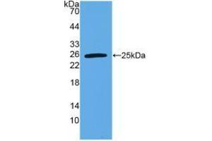 Western blot analysis of recombinant Human VEGI. (TNFSF15 antibody  (AA 67-251))