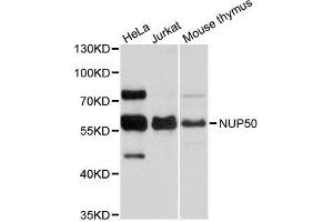 Western blot analysis of extracts of various cell lines, using NUP50 antibody (ABIN5996047) at 1:3000 dilution. (NUP50 antibody)