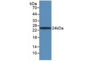 Detection of Recombinant IL6, Ovine using Monoclonal Antibody to Interleukin 6 (IL6) (IL-6 antibody  (AA 30-208))