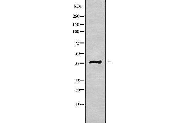 MAGEB3 antibody  (N-Term)