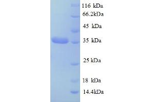 SDS-PAGE (SDS) image for Caspase 14, Apoptosis-Related Cysteine Peptidase (CASP14) (AA 153-240) protein (GST tag) (ABIN5709199) (CASP14 Protein (AA 153-240) (GST tag))