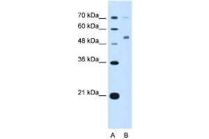 CDR2 antibody used at 5 ug/ml to detect target protein. (CDR2 antibody  (N-Term))