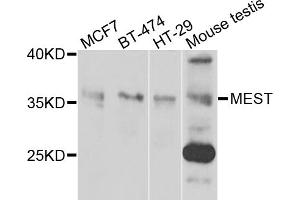 Western blot analysis of extracts of various cell lines, using MEST antibody. (MEST antibody)