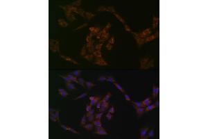 Immunofluorescence analysis of C6 cells using IRF6 Rabbit mAb (ABIN1680921, ABIN3017588, ABIN3017589 and ABIN7101507) at dilution of 1:100 (40x lens). (IRF6 antibody)