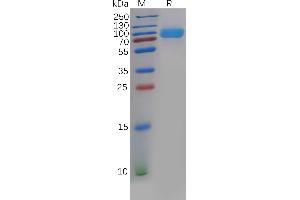 Human B7-H3 Protein, mFc-His Tag on SDS-PAGE under reducing condition. (CD276 Protein (CD276) (AA 29-245) (mFc-His Tag))