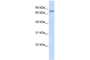 ADAM15 antibody used at 1 ug/ml to detect target protein. (ADAM15 antibody  (Middle Region))