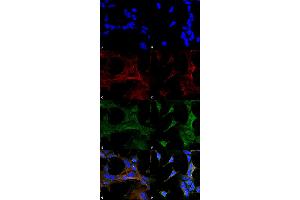 Immunocytochemistry/Immunofluorescence analysis using Mouse Anti-4-Hydroxy-2-hexenal Monoclonal Antibody, Clone 6F10 . (4-Hydroxy-2-Hexenal (4-HHE) antibody (PerCP))