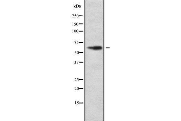 HIC2 antibody  (Internal Region)