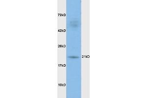 Rat brain lysates probed with Anti DHFR Polyclonal Antibody, Unconjugated (ABIN1387277) at 1:200 in 4 °C. (Dihydrofolate Reductase antibody)