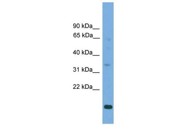 SLC25A44 antibody  (Middle Region)