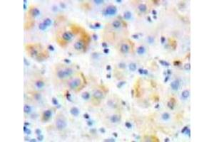 Used in DAB staining on fromalin fixed paraffin-embedded Liver tissue (P-Selectin antibody  (AA 58-259))