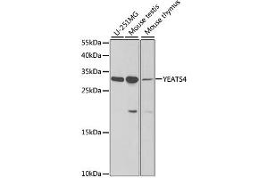 Western blot analysis of extracts of various cell lines, using YEATS4 antibody. (GAS41 antibody)