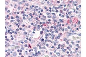 Immunohistochemical staining of Thymus using anti- RORC antibody ABIN122406 (RORC antibody)