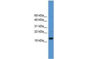 Image no. 1 for anti-Caspase 1 (CASP1) (AA 30-79) antibody (ABIN6745426) (Caspase 1 antibody  (AA 30-79))