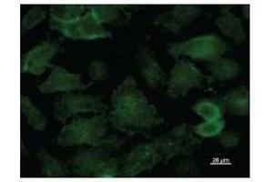 Immunostaining analysis in HeLa cells. (KAT5 antibody)