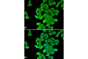 Immunofluorescence analysis of HeLa cells using SMYD2 antibody. (SMYD2A antibody)