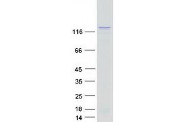 SMARCA5 Protein (Myc-DYKDDDDK Tag)