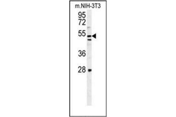 KIAA1609 antibody  (C-Term)