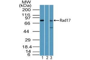 Image no. 1 for anti-RAD17 (RAD17) antibody (ABIN960319) (RAD17 antibody)