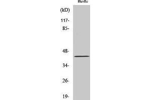 Western Blotting (WB) image for anti-Ret Finger Protein-Like 4A (RFPL4A) (Internal Region) antibody (ABIN6287235) (RFPL4A antibody  (Internal Region))