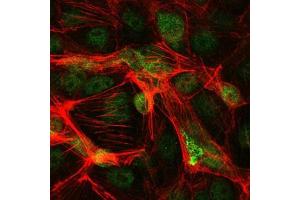 Immunofluorescence (IF) image for anti-Jun Proto-Oncogene (JUN) antibody (ABIN968994)