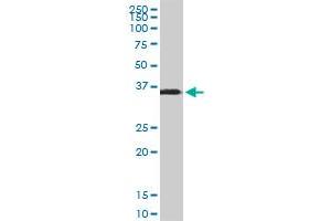 SPARC monoclonal antibody (M02A), clone 1B2. (SPARC antibody  (AA 1-303))