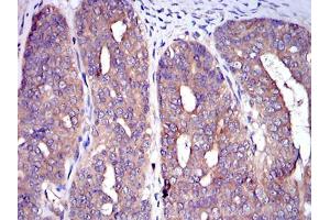 Immunohistochemistry (IHC) image for anti-Cas-Br-M (Murine) Ecotropic Retroviral Transforming Sequence (CBL) antibody (ABIN968993)