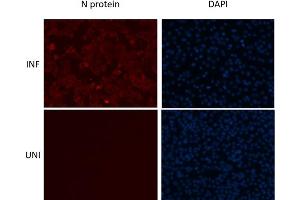 Immunofluorescence (IF) image for anti-SARS-Coronavirus Nucleocapsid Protein (SARS-CoV N) antibody (ABIN6952544)