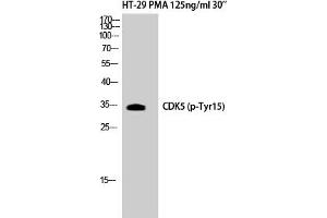 Western Blotting (WB) image for anti-Cyclin-Dependent Kinase 5 (CDK5) (pTyr15) antibody (ABIN5958167) (CDK5 antibody  (pTyr15))