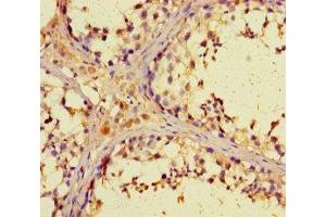 Immunohistochemistry of paraffin-embedded human testis tissue using ABIN7176469 at dilution of 1:100 (ZNF662 antibody  (AA 182-452))