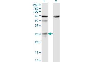 TWSG1 antibody  (AA 124-223)