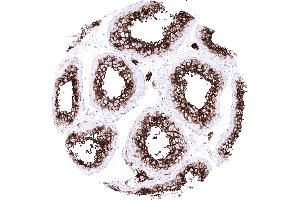 Testis Leydig cells and spermatocytes of the testis show a particularly strong ACE2 immunostaining in the testis (Recombinant ACE2 antibody  (AA 705-805))