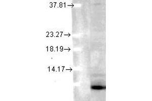 Image no. 1 for anti-Ubiquitin (Ubiquitin) antibody (ABIN1502295) (Ubiquitin antibody)