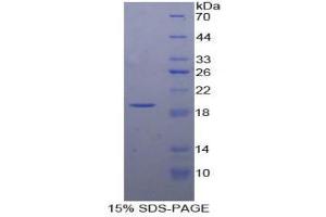 SDS-PAGE (SDS) image for Insulin-Like Growth Factor Binding Protein 3 (IGFBP3) (AA 106-241) protein (His tag) (ABIN2125297) (IGFBP3 Protein (AA 106-241) (His tag))