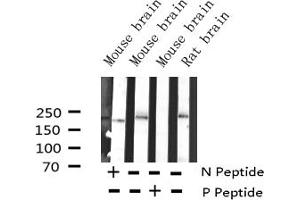 Western blot analysis of Phospho-BRCA1 (Ser1524) Antibody expression in mouse brain and rat brain tissues lysates. (BRCA1 antibody  (pSer1524))