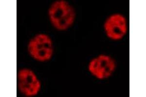 ABIN6267591 staining HeLa by IF/ICC. (MEF2A antibody  (pThr319))