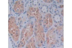 Used in DAB staining on fromalin fixed paraffin- embedded Kidney tissue (RIPK2 antibody  (AA 432-540))