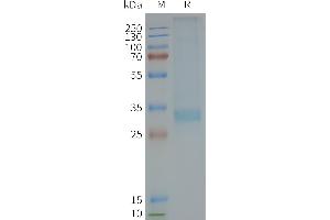 Human MC4R-Nanodisc, Flag Tag on SDS-PAGE (MC4R Protein)