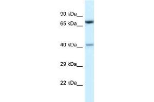 WB Suggested Anti-Prmt7 Antibody   Titration: 1. (PRMT7 antibody  (C-Term))