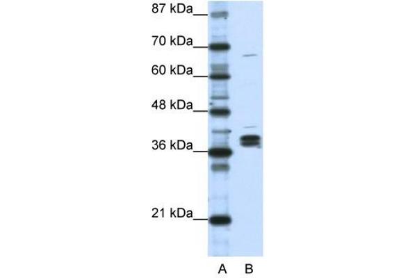 HNRPDL antibody  (Middle Region)