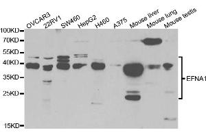 Western blot analysis of extracts of various cell lines, using EFNA1 antibody (ABIN5973078) at 1/1000 dilution. (Ephrin A1 antibody)