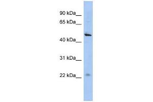 C12ORF50 antibody used at 1 ug/ml to detect target protein. (C12ORF50 antibody  (N-Term))