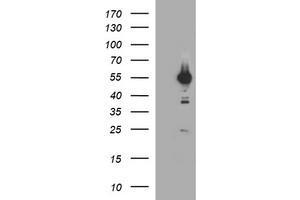 Western Blotting (WB) image for anti-Tubulin, alpha 1B (TUBA1B) antibody (ABIN1501554) (TUBA1B antibody)