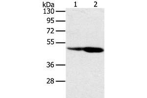 Western Blot analysis of Hepg2 and hela cell using SNX8 Polyclonal Antibody at dilution of 1:400 (SNX8 antibody)