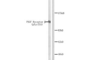Western blot analysis of extracts from NIH/3T3 cells treated with PDGF. (PDGFRB antibody  (pTyr751))