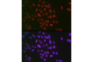 Immunofluorescence analysis of U-2 OS cells using Symmetric DiMethyl-Histone H3-R26 Rabbit pAb (ABIN3017473, ABIN3017474, ABIN3017475 and ABIN6220103) at dilution of 1:100 (40x lens). (Histone 3 antibody  (H3R26me2))